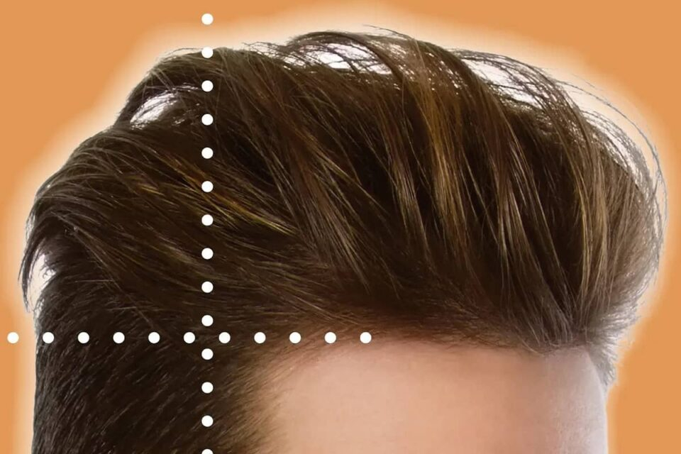 how does hair transplant work