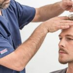 hair transplant treatment
