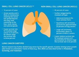 Common Types of Lung Cancer