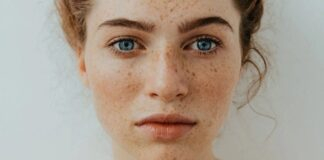 sunspots on skin treatment